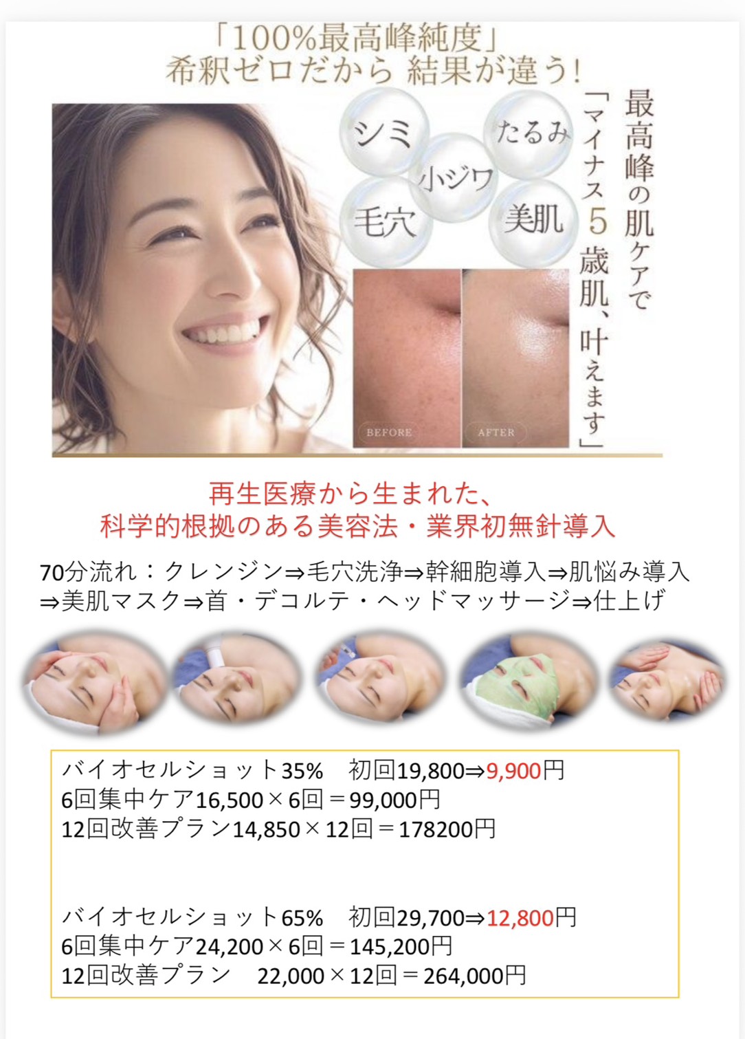 60代ヒト幹細胞