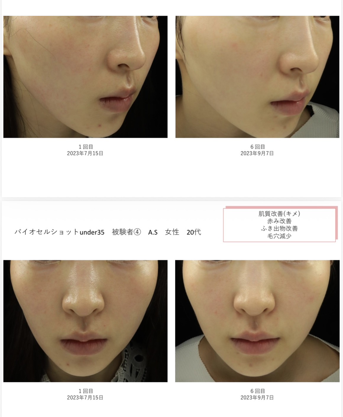 ヒト幹細胞美容液