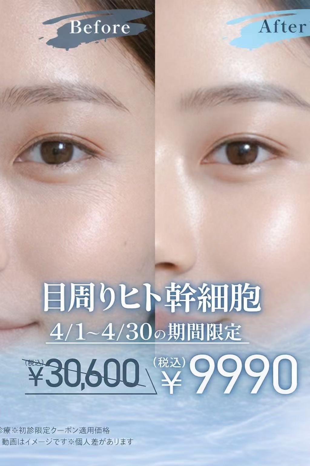 KOO 受付エリア